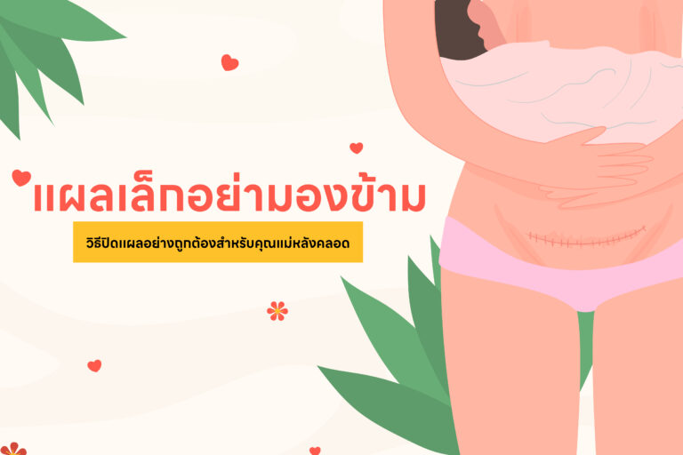 แผลเล็กแต่อย่ามองข้าม “วิธีปิดแผลอย่างถูกวิธีสำหรับคุณแม่หลังคลอด”