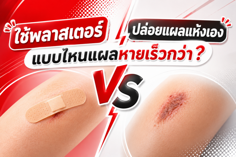 ใช้พลาสเตอร์ Vs ปล่อยเเผลเเห้งเอง เเบบไหนเเผลหายเร็วกว่า?