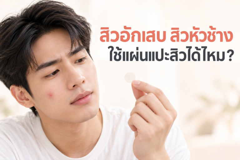 สิวอักเสบ สิวหัวช้าง ใช้แผ่นแปะสิวได้ไหม?