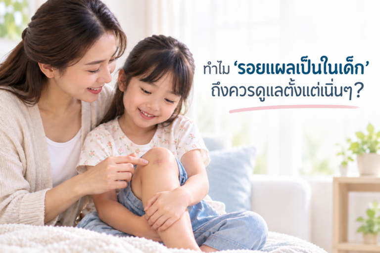 ทำไม “รอยแผลเป็นในเด็ก” ถึงควรดูแลตั้งแต่เนิ่นๆ?