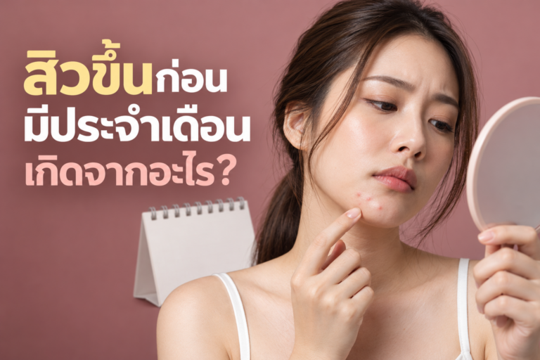 สิวขึ้นก่อนมีประจำเดือน เกิดจากอะไร?