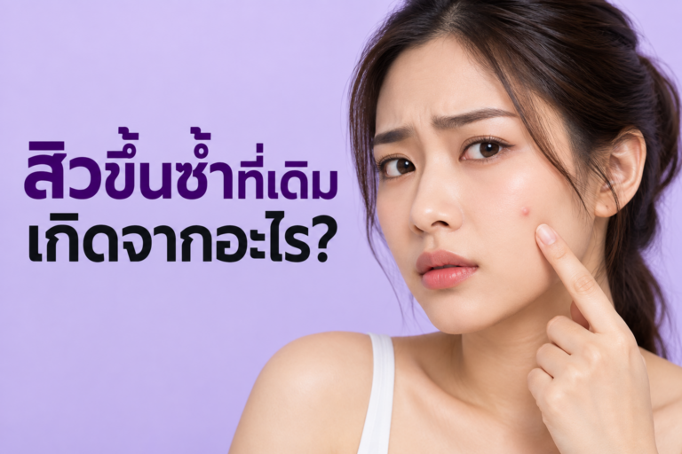 สิวขึ้นซ้ำที่เดิม เกิดจากอะไร? ทำไมบางจุดเป็นไม่หายสักที
