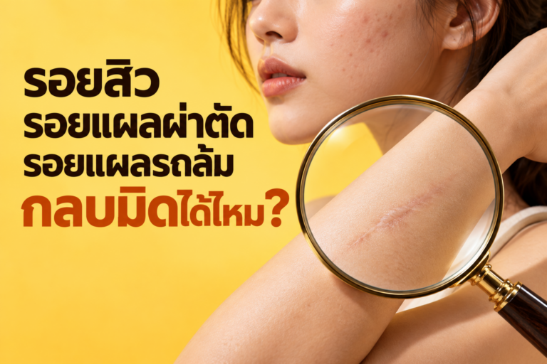 รอยสิว แผลผ่าตัด แผลรถล้ม “กลบมิด” ได้จริงไหม?