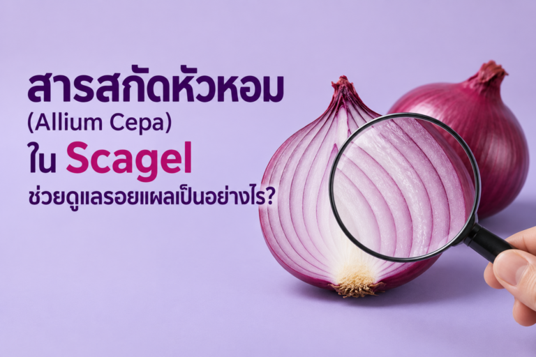 เจาะลึก “สารสกัดจากหัวหอม” (Allium Cepa) ตัวช่วยลดรอยแผลเป็นที่ Cybele Scagel ไว้วางใจ